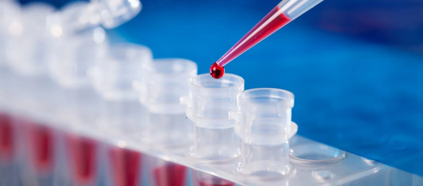PCR: Είναι αλήθεια ότι το τεστ για τον κορωνοϊό δημιουργήθηκε το 1983;